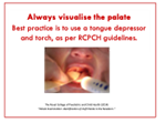 Palate Identification